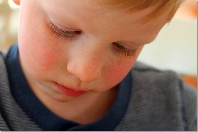 freckleboy