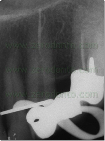 FIG N 23 