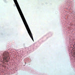 ameba02.jpg