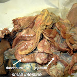 duodenum_L.JPG