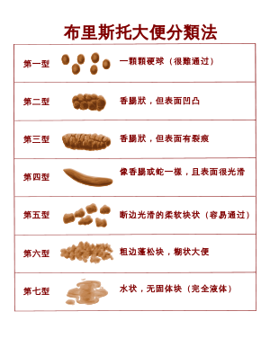 布里斯托大便分類法 布里斯托大便分類法