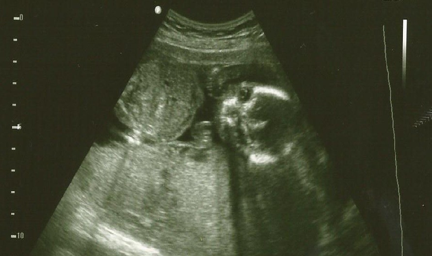 [babyaug1%255B3%255D.jpg]