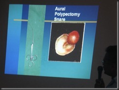 aural polypectomy snare