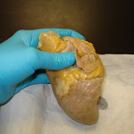 auricle.JPG