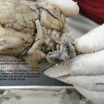 brain_dissect18.jpg brain_dissect18.jpg