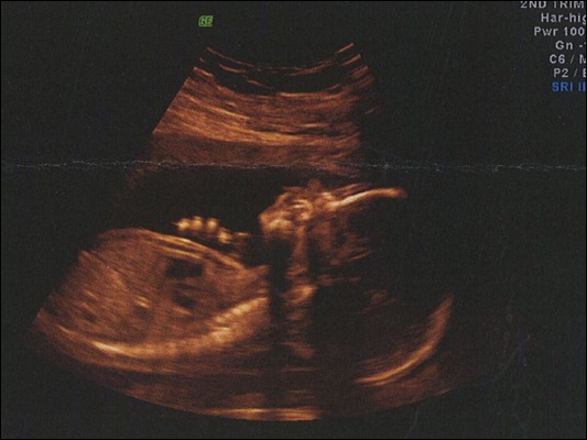 21w2