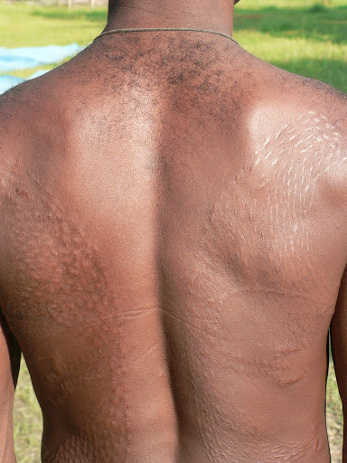 Crocodile Scarification