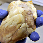 z_person_holding_a_heart.JPG