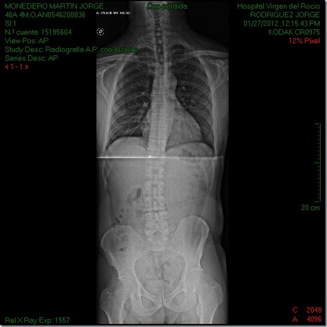 Radiografia_Jorge_Monedero