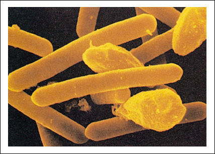 o_clostridium botulinum1.jpg