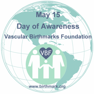 vascular birthmarks