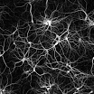 neuron_culture_800px_copyright_2004_Paul_De_Koninck_www.greenspine.ca.jpg