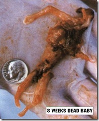 8_weeks_dead_baby3