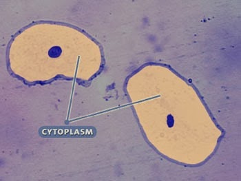 [sitoplasma-bakteri1%255B4%255D.jpg]