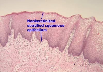 Non keratinized stratified epithelium