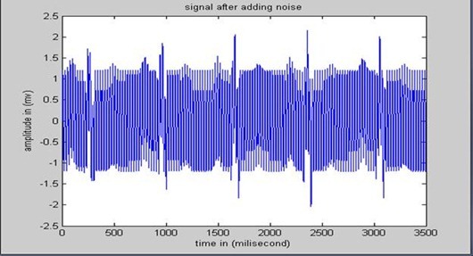 ECG signal with noise