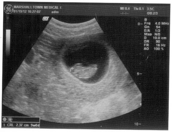 [03-18-2012%252012_52_20PM%255B3%255D.jpg]