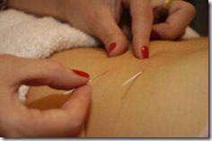 acupuntura curitiba gravidez