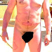 PlaquePsoriasis2.jpg