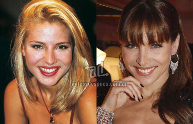 La nueva nariz operada de Elsa Pataky