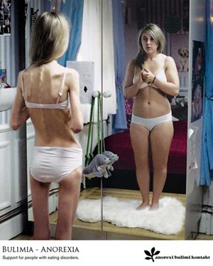 anorexia-y-bulimia