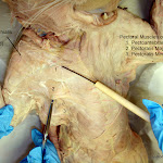 deltoid_L.JPG