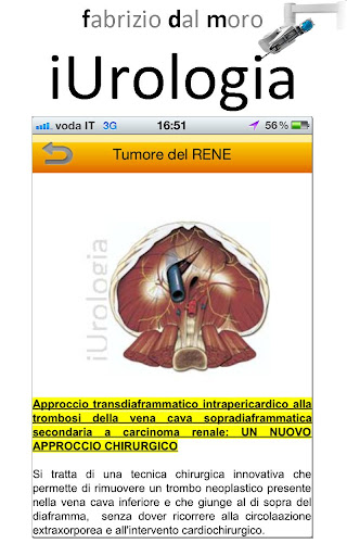 【免費醫療App】iUrologia-FDM-APP點子