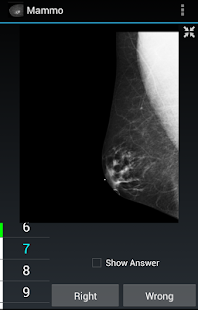 How to get Radiology Flashcards: Mammo 1.4 apk for laptop
