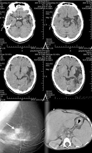 DICOM VIEWER 2012