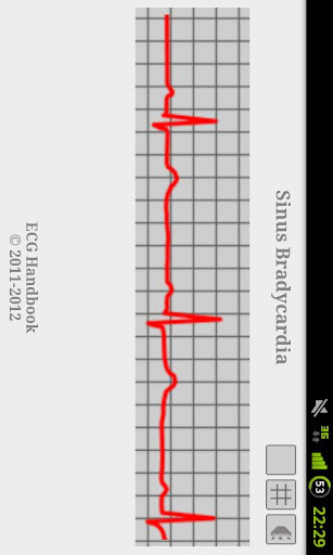 【免費醫療App】Heart ECG Handbook - Lite-APP點子