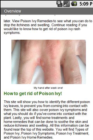 Poison Ivy Information