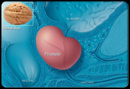 How to download Prostate Cancer Symptoms 1.0 apk for bluestacks