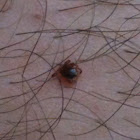 Deer tick