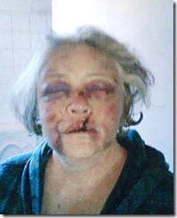 KotieMostertApril112008BalfourFarmAttackVictimPolicePhoneLinesOut