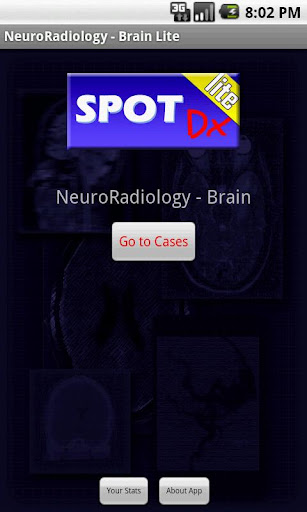 NeuroRadiology - Brain Lite