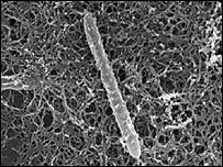 [bacteria_bug1[6].jpg]