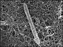 bacteria_bug1