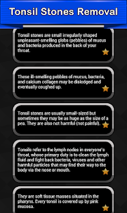 How to mod Tonsil Stones Removal 1.2 unlimited apk for pc