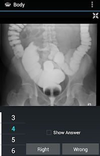 How to install Radiology Flashcards: Body 1.4 mod apk for laptop