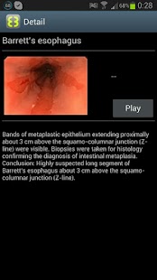 How to get ENDO3®GASTRO 1.12 unlimited apk for pc