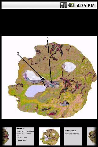 Brain -Neurological Flashcards