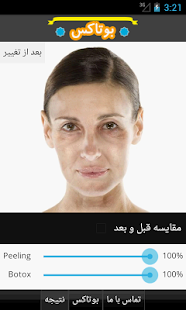 How to install بوتاکس lastet apk for bluestacks