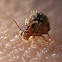 Springtail
