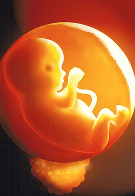 http://1.bp.blogspot.com/_cpKHGqBVuL8/SOp0kWvj1KI/AAAAAAAAAj8/WIdS6_rEyRU/s400/Foetus060806_429x600.jpg