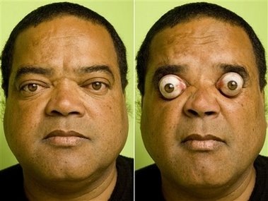POPPING Man sets sights on eye-popping