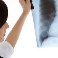 Managing Acute Pulmonary Oedema