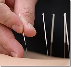 Acupuncture