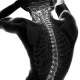 Spinal Trauma: Modern Nursing Care and Appropriate Treatment