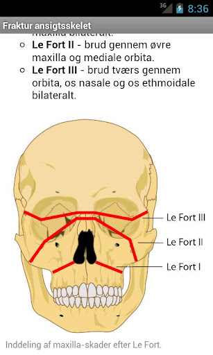 Skadehåndbogen