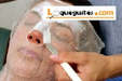 Limpieza Facial Profunda